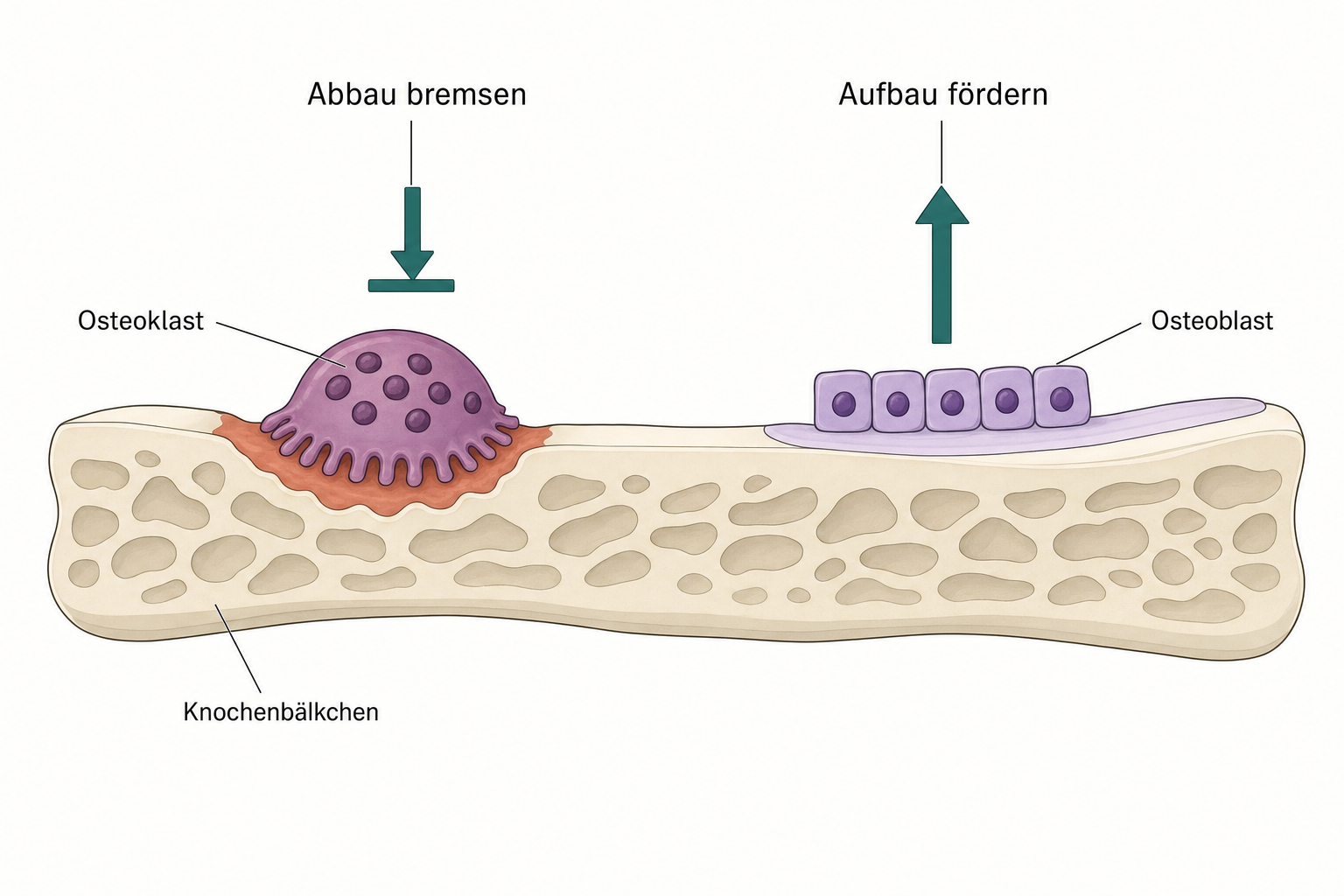 Schnitt durch ein Knochenbälkchen mit einer großen Abbauzelle links und einer Reihe kleiner Aufbauzellen rechts, darüber zwei Pfeile für das Bremsen des Abbaus und das Fördern des Aufbaus
