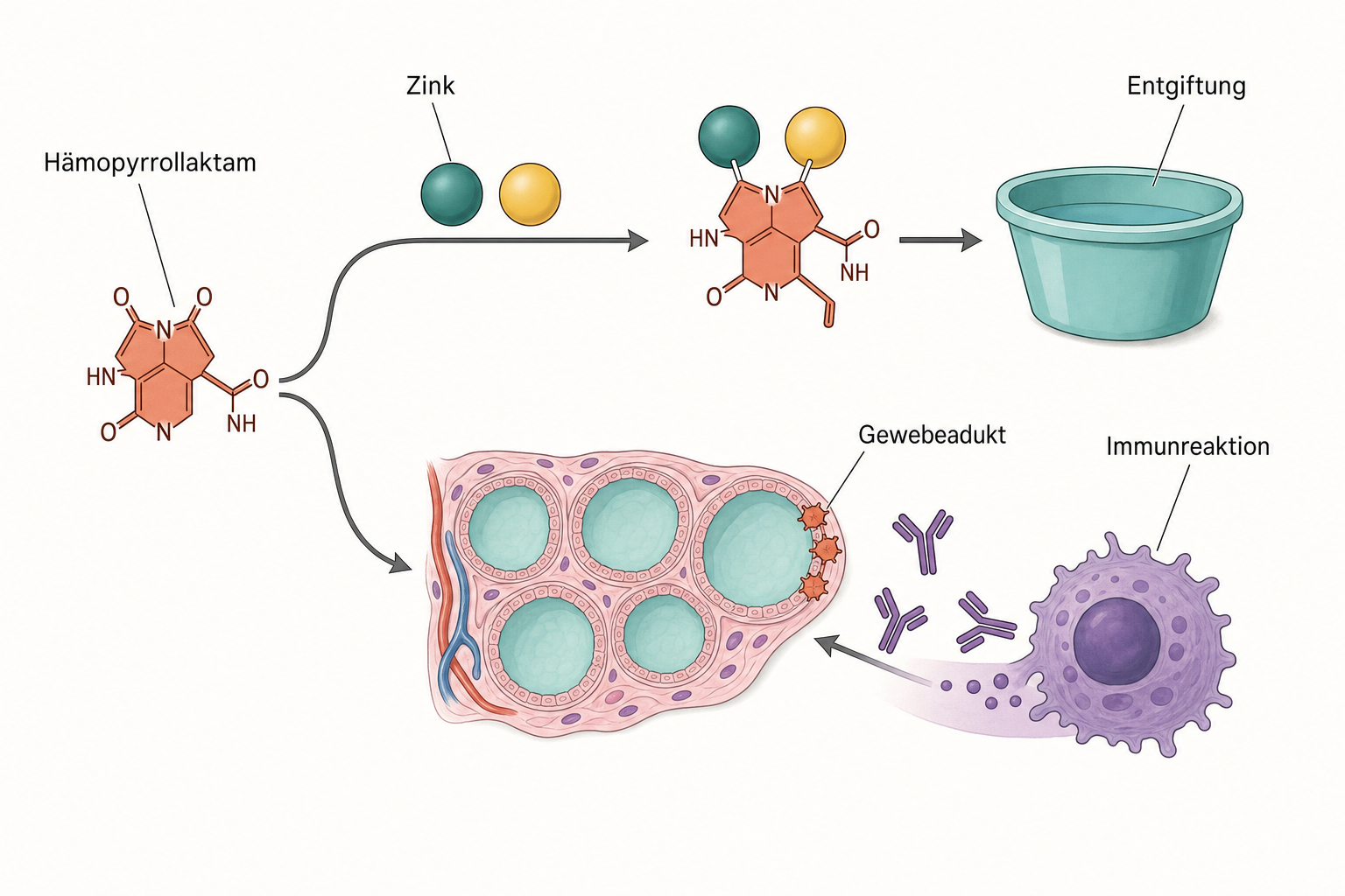 Schema mit zwei Wegen für ein Stoffwechsel-Nebenprodukt: gebunden an Zink zur Ausscheidung oder eingelagert im Schilddrüsengewebe, wo Antikörper und eine Immunzelle andocken