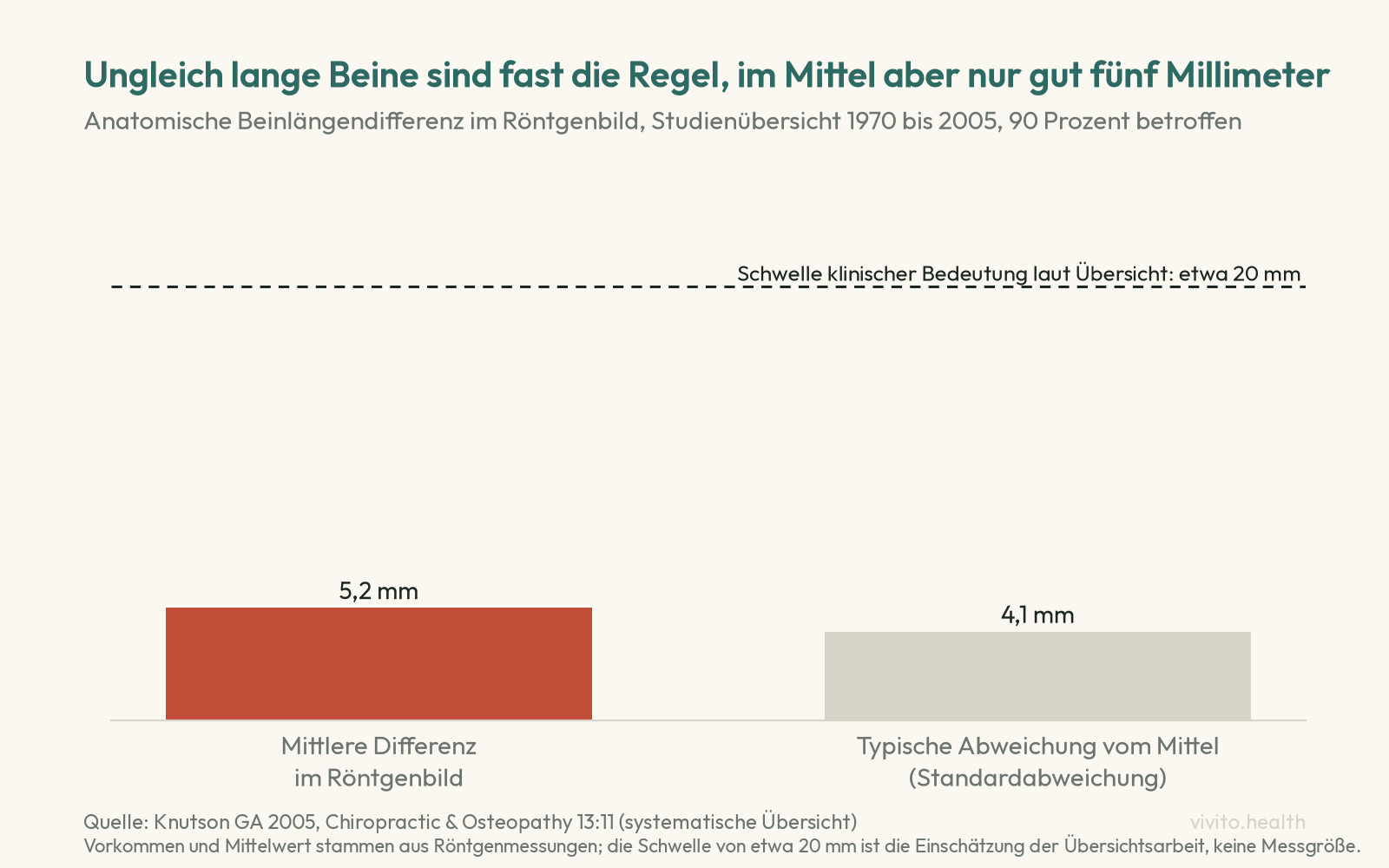 Säulendiagramm aus einer Übersichtsarbeit zu anatomischen Beinlängenunterschieden: Mittelwert 5,2 Millimeter, Standardabweichung 4,1 Millimeter, dazu eine gestrichelte Linie bei etwa 20 Millimetern als Schwelle klinischer Bedeutung