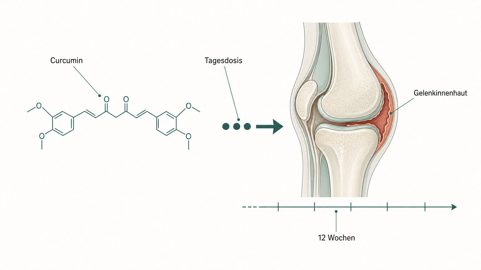 Schematische Illustration von Curcumin-Molekül, Dosierungspunkten und Zeitstrahl neben einem Kniegelenk