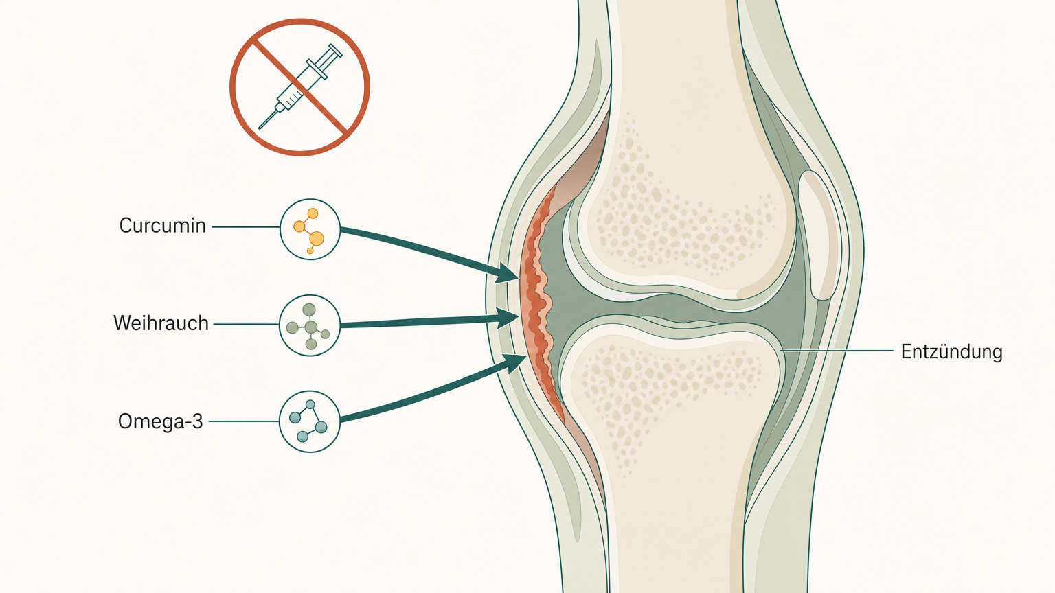 Schematische Illustration natürlicher Wirkstoffe, die auf eine entzündete Gelenkinnenhaut wirken