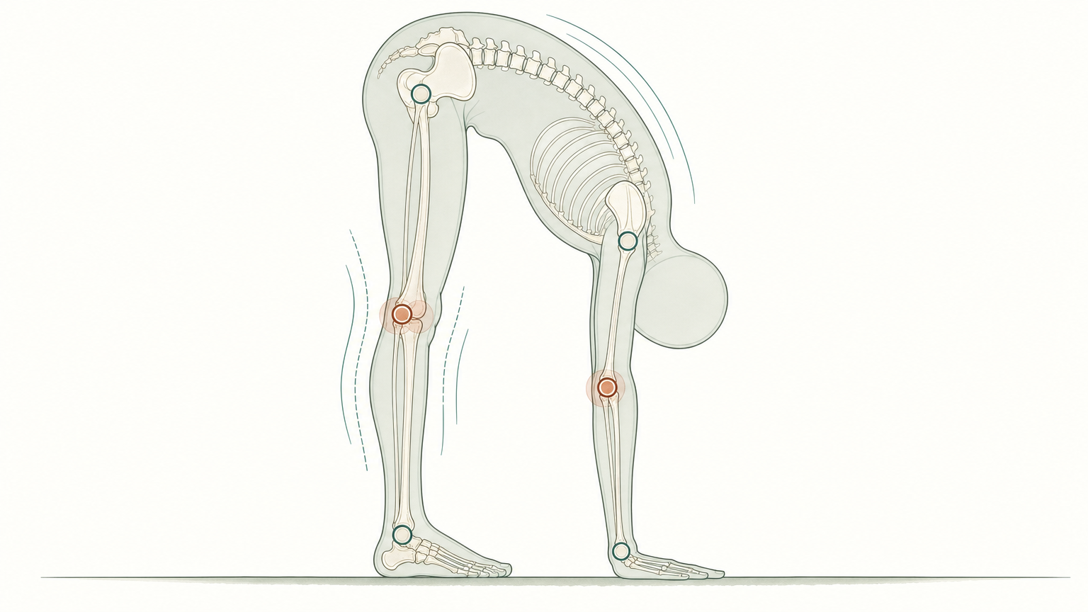 Wissenschaftliche Grafikfigur in tiefer Vorbeuge mit gestreckten Knien und flach aufliegenden Händen, das durchscheinende Skelett zeigt die gerundete Wirbelsäule, Knie- und Ellenbogengelenke sind terrakottafarben markiert