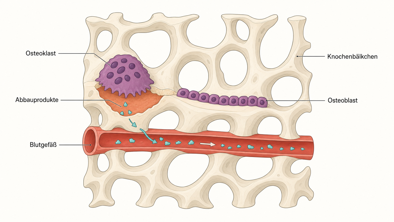 Schnitt durch Knochengewebe mit elfenbeinfarbenen Knochenbälkchen, einem großen Osteoklasten über einer terrakottafarbenen Abbaumulde, kleinen Osteoblasten und einem Blutgefäß, in das Abbauprodukte übertreten